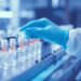 Malattia renale cronica associata a diabete 2, speranze da nuova terapia