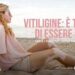 Salute, Giornata vitiligine: al via campagna ‘Oltre falsi miti verso nuove possibilità’