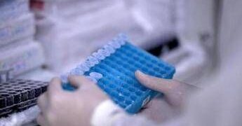 Covid, ecco perché può causare trombosi, studio svela ruolo chiave di un enzima