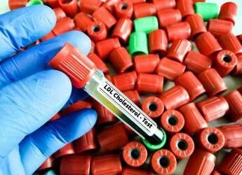 Colesterolo Ldl, per abbassalo in sviluppo nuova terapia con tripla combinazione 