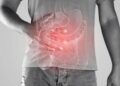 Malattie infiammatorie croniche, l’indagine: ‘4 pazienti su 5 non ricevono consulenze nutrizionali’