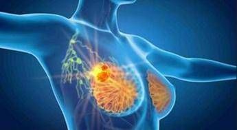 Cancro seno iniziale Her2+, con anticorpo farmaco-coniugato -53% recidiva