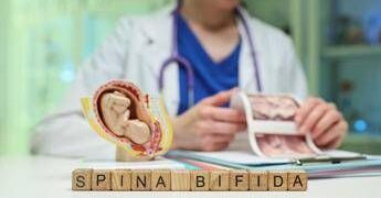 Giornata spina bifida, da prevenzione a nuove tecniche chirurgiche
