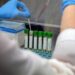 Medicina, italiani svelano errori nascosti nelle cellule: “Possibile ruolo in più malattie”