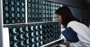 Cancro, 4 sintomi ‘insoliti’ che bisogna conoscere: parola di oncologo