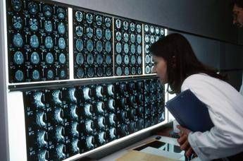 Cancro, 4 sintomi ‘insoliti’ che bisogna conoscere: parola di oncologo