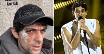 Bresh ferito al volto da un Dobermann, come sta il cantante