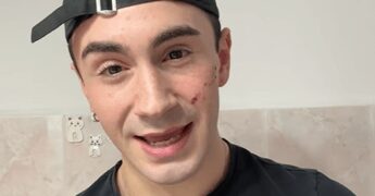 Genova, 19enne denuncia aggressione omofoba: “Sfregiato al viso con coltellino”