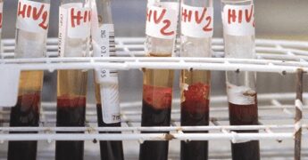 Hiv, oggi a Bari incontro su terapie long acting e prevenzione