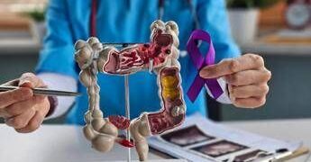 Tumori del colon retto, Int Milano in progetto Ue che punta a prevedere efficacia immunoterapia