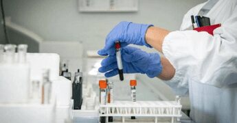 Alzheimer, test del sangue possono prevedere l’inizio dei sintomi