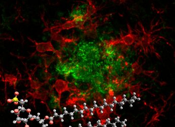 Alzheimer: una “molecola smart” del Cnr promette di rivoluzionare la terapia