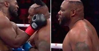 Boxe ‘da record’, perde il parrucchino per un pugno ma vince il match