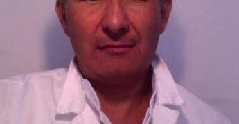 ‘Faccia a luna piena’ e pelle sottile, è la sindrome di Cushing. Cos’è e come si cura