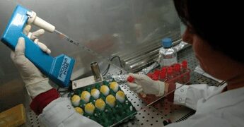 Lupus eritematoso, Moroni (San Raffaele): “Priorità approccio multidisciplinare”