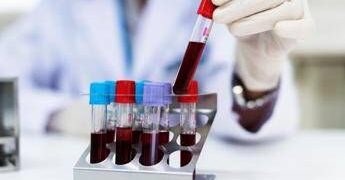 Aviaria, cos’è il virus H9N2: come si trasmette e i rischi per l’uomo