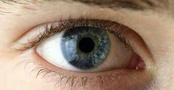 Chirurgia vitroretinica, al Miulli di Bari formazione sulla gestione dei casi complessi