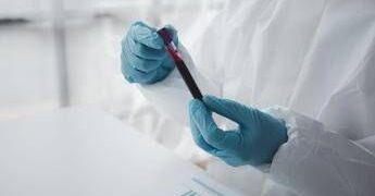 Epatite A in forte crescita in Italia: Lazio, Campania e Puglia le regioni con più casi