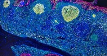 Irccs Pascale Napoli, ‘mappa Gps’ delle cellule rivoluziona l’immunoterapia