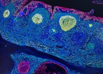 Irccs Pascale Napoli, ‘mappa Gps’ delle cellule rivoluziona l’immunoterapia