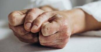 Open day psoriasi, l’11 marzo visite gratis in 90 ospedali Bollino rosa