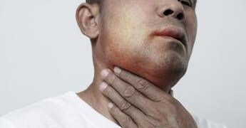 Angioedema ereditario, Aifa estende uso lanadelumab dai 2 anni di età