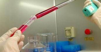 Ematologia, Gimema: “Oltre 17mila pazienti coinvolti in studi clinici nazionali”