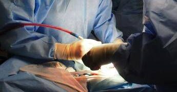 Interventi aorta, 2 studi ‘prevedono’ pazienti più a rischio mortalità