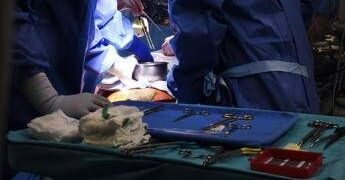 Malattia cronica da trapianto contro l’ospite, via libera Ue a belumosudil ﻿