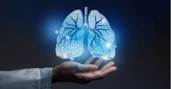 Risultati positivi per tozorakimab nella riduzione delle riacutizzazioni nella Bpco