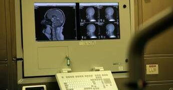 Sogni agitati sintomo Parkinson? Medici anti-bufale ‘può accadere, si fa polisonnografia’