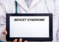 Giornata sindrome Behçet, esperto: “Oggi possiamo prevenire cecità”