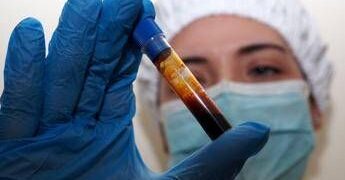 Hantavirus, negativo il turista inglese in quarantena a Milano. Test per una donna ricoverata a Messina