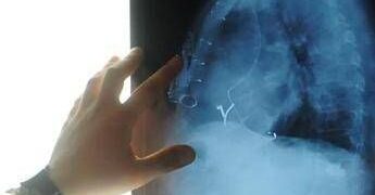 Radiologia interventistica, Ssn e fondazioni per cure più accessibili