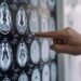 Parkinson, in Italia 300mila persone malate: 10% ha diagnosi prima dei 50 anni