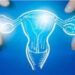 Tumori dell’endometrio, Picardo (Acto Piemonte): “Con dostarlimab trattamenti più efficaci per più donne”