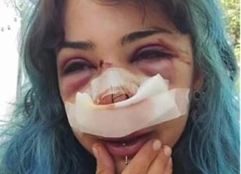 Bari, studentessa picchiata al parco: indagati per lesioni e rapina custode bagni e il compagno