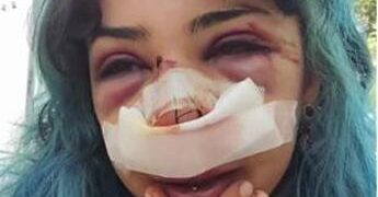 Studentessa picchiata a Bari, due adulti identificati per il pestaggio