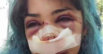 Bari, studentessa picchiata nei bagni denuncia nuovo episodio: “Mi hanno accerchiata”