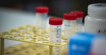 Difterite, quali rischi? Dalla trasmissione alla vaccinazione, ecco cosa sapere