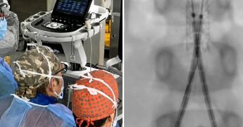 Incidente con un’acquasantiera in chiesa, bimba di 6 anni operata d’urgenza all’aorta a Bari