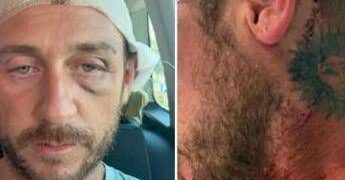 “Io aggredito a sassate in Sardegna da 30 persone perché gay”, la denuncia sui social ﻿