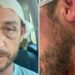 “Io aggredito a sassate in Sardegna da 30 persone perché gay”, la denuncia sui social ﻿