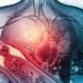 Arterosclerosi, studio: “Nuova molecola riduce di più il colesterolo cattivo”