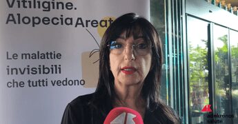Cassia (Aipaf): “Con nuove terapie Ssn riconosca alopecia per sostenere i pazienti”