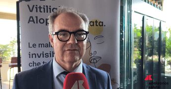 Costanzo (Sidemast): “Upadacitinib blocca cellule infiammatorie in vitiligine e alopecia areata”