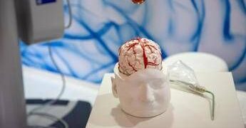 Dai gliomi al Parkinson, così l’intelligenza artificiale aiuta la Neurochirurgia