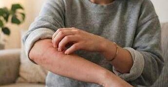 Malattia della pioggia, perché se ne parla: cos’è e sintomi