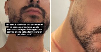 Mr. Daniel, il make-up artist dei vip, aggredito e rapinato a Milano: il racconto choc sui social