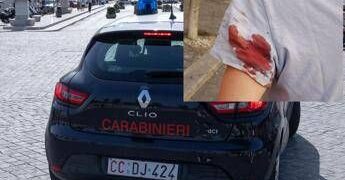 Spari con arma ad aria compressa in centro a Roma, la donna colpita: “Mi hanno detto che si ripetono da giorni”